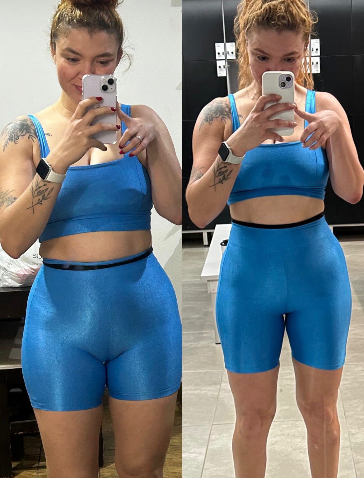 Kit 2 Meses de Tratamento Lip moro HD